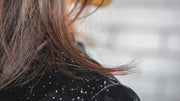 What Causes Dandruff — and How to Control It for Good