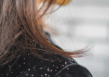 What Causes Dandruff — and How to Control It for Good